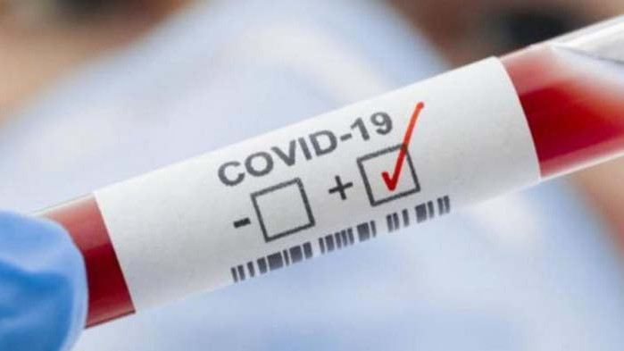 41 нови случая на covid-19 в област Русе  за последното денонощие